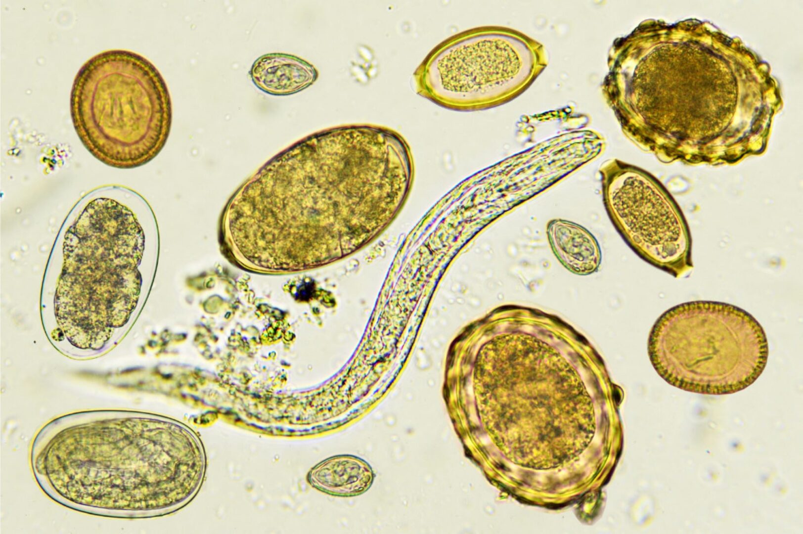 Close-up image of parasites, in shades of yellow.